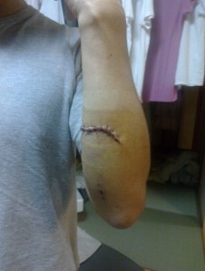 blog_import_50828bda5ede8